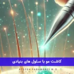 کاشت مو به روش سلول بنیادی