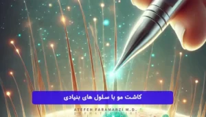 کاشت مو به روش سلول بنیادی